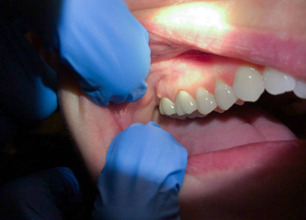 Best Orthodontic Emergency Dentist in Spry, PA